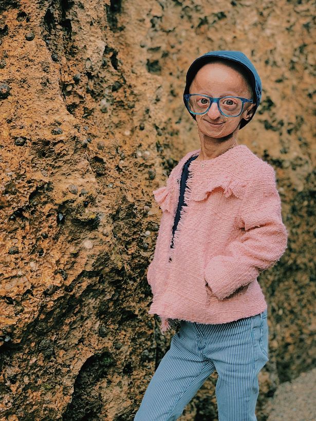 progeria adult